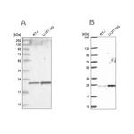 NOP16 Antibody in Western Blot (WB)