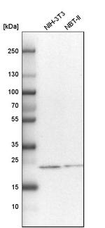 NOP16 Antibody in Western Blot (WB)