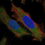 ZNF622 Polyclonal Antibody