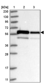 ZNF622 Antibody in Western Blot (WB)
