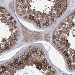 ZNF622 Antibody in Immunohistochemistry (IHC)