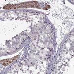 GL54D Antibody in Immunohistochemistry (IHC)