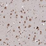 FAM13B Antibody in Immunohistochemistry (Paraffin) (IHC (P))