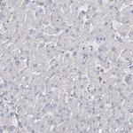 FAM13B Antibody in Immunohistochemistry (Paraffin) (IHC (P))