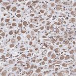 FAM13B Antibody in Immunohistochemistry (Paraffin) (IHC (P))