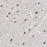 WAC Polyclonal Antibody