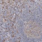 CCNJ Polyclonal Antibody