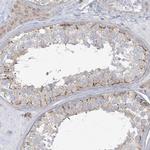 DJC18 Antibody in Immunohistochemistry (IHC)
