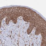 HARS Antibody in Immunohistochemistry (IHC)