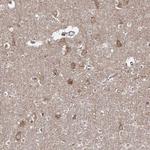 HARS Antibody in Immunohistochemistry (IHC)