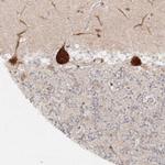 HARS Antibody in Immunohistochemistry (IHC)