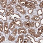 HARS Antibody in Immunohistochemistry (IHC)