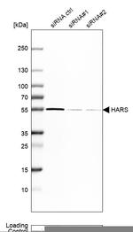 HARS Antibody in Western Blot (WB)
