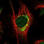 HIBCH Polyclonal Antibody