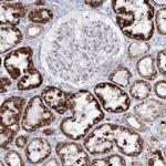 HIBCH Antibody in Immunohistochemistry (IHC)