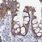 HIBCH Antibody in Immunohistochemistry (IHC)