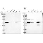 HIBCH Antibody in Western Blot (WB)