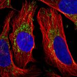 HIBCH Polyclonal Antibody