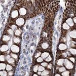 HIBCH Antibody in Immunohistochemistry (IHC)