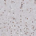 DDX46 Antibody in Immunohistochemistry (Paraffin) (IHC (P))