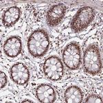 DDX46 Antibody in Immunohistochemistry (Paraffin) (IHC (P))