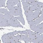DDX46 Antibody in Immunohistochemistry (Paraffin) (IHC (P))
