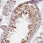 DDX46 Antibody in Immunohistochemistry (Paraffin) (IHC (P))