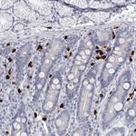 CCDC147 Polyclonal Antibody