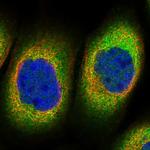 TTC1 Polyclonal Antibody