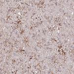 TTC1 Antibody in Immunohistochemistry (Paraffin) (IHC (P))