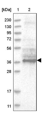 TTC1 Antibody in Western Blot (WB)