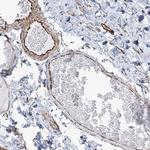 SCLT1 Antibody in Immunohistochemistry (Paraffin) (IHC (P))