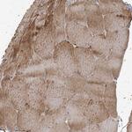 RNF145 Antibody in Immunohistochemistry (Paraffin) (IHC (P))