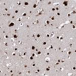 MATR3 Antibody in Immunohistochemistry (Paraffin) (IHC (P))