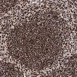 MATR3 Antibody in Immunohistochemistry (Paraffin) (IHC (P))