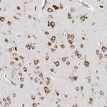 LAR4B Antibody in Immunohistochemistry (Paraffin) (IHC (P))