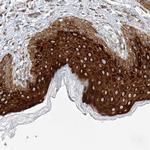 LAR4B Antibody in Immunohistochemistry (Paraffin) (IHC (P))