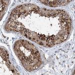 LAR4B Antibody in Immunohistochemistry (Paraffin) (IHC (P))