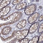 WNT8B Polyclonal Antibody