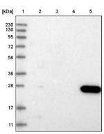 CMBL Antibody in Western Blot (WB)