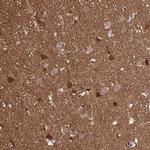 TPPP Antibody in Immunohistochemistry (IHC)