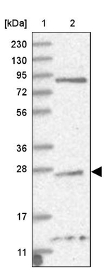 TPPP Antibody in Western Blot (WB)