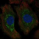 TPPP Polyclonal Antibody