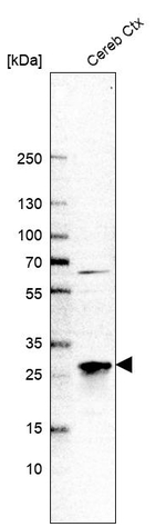 TPPP Antibody in Western Blot (WB)