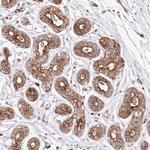 COMMD3 Antibody in Immunohistochemistry (Paraffin) (IHC (P))
