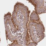 COMMD3 Antibody in Immunohistochemistry (Paraffin) (IHC (P))
