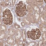 COMMD3 Antibody in Immunohistochemistry (Paraffin) (IHC (P))