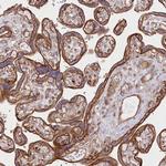 COMMD3 Antibody in Immunohistochemistry (Paraffin) (IHC (P))