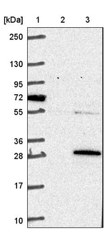 COMMD3 Antibody in Western Blot (WB)