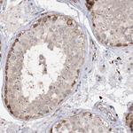 PIWIL4 Antibody in Immunohistochemistry (Paraffin) (IHC (P))